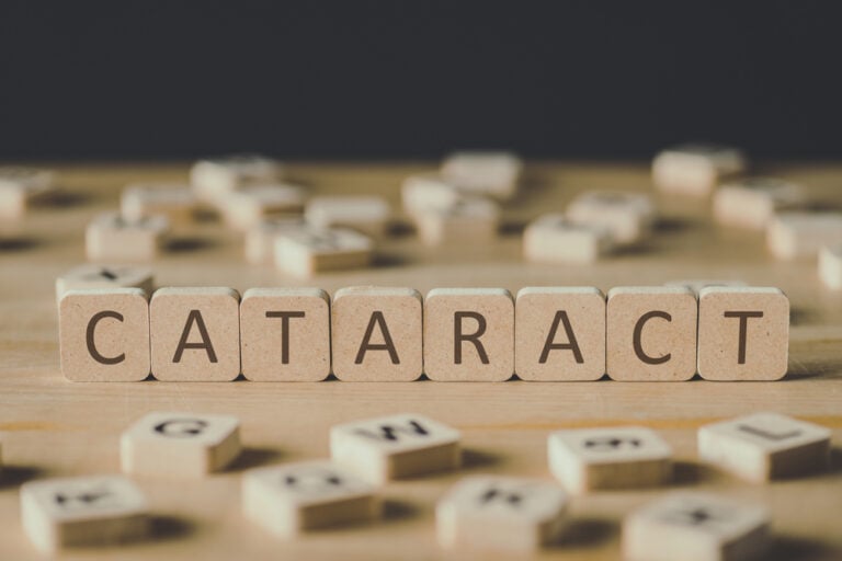 Cataract Surgery